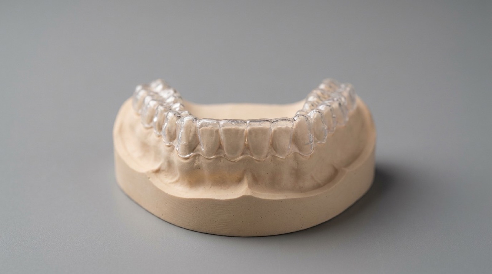 Clear aligner seated on an upper-arch model after finishing